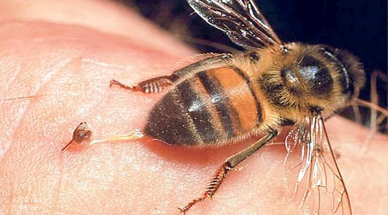 Что делать при укусе пчёлы?