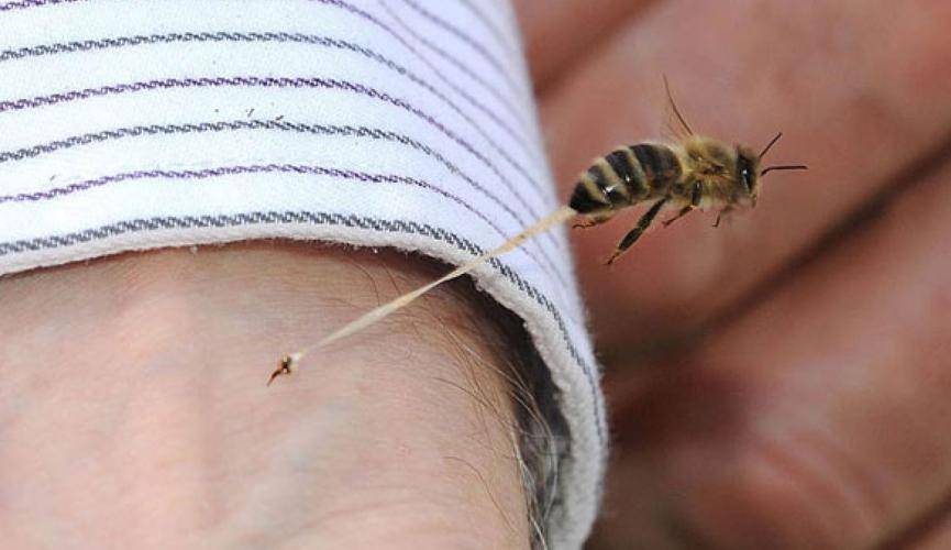 Что делать, если пчела укусила в голову, глаз, шею, руку, палец, ногу