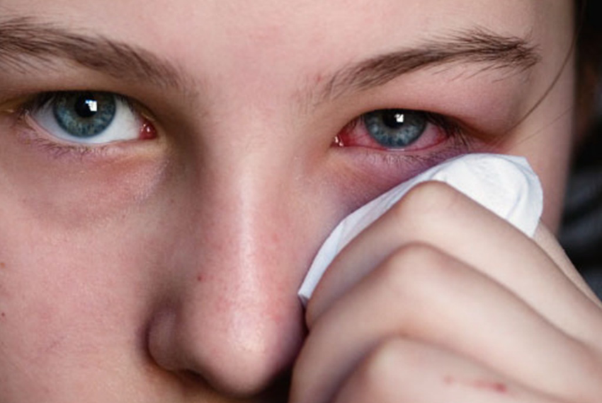 Помутнение роговицы глаза: причины и лечение