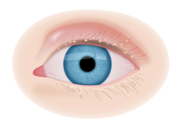 Болезни глаз крс: симптомы и лечение