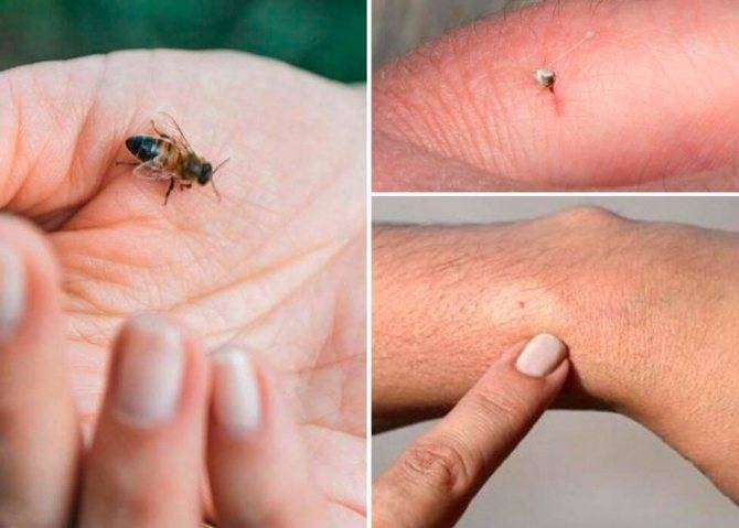 Какое количество раз может укусить оса, может ли пчела ужалить дважды